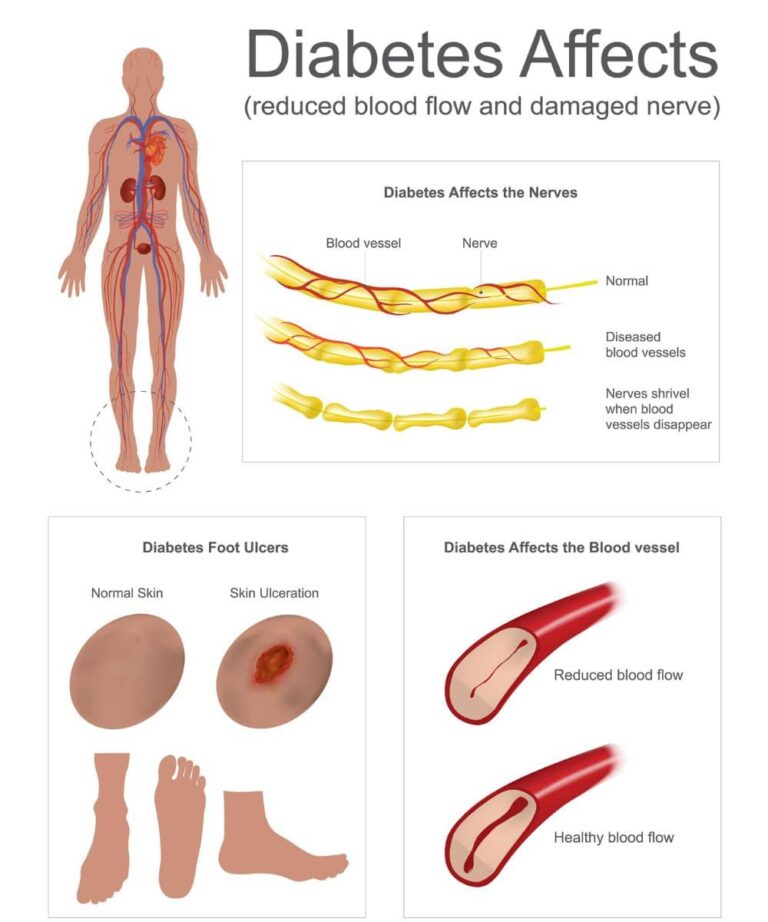 Diabetic Vascular Disease Imaging And Interventional Specialists